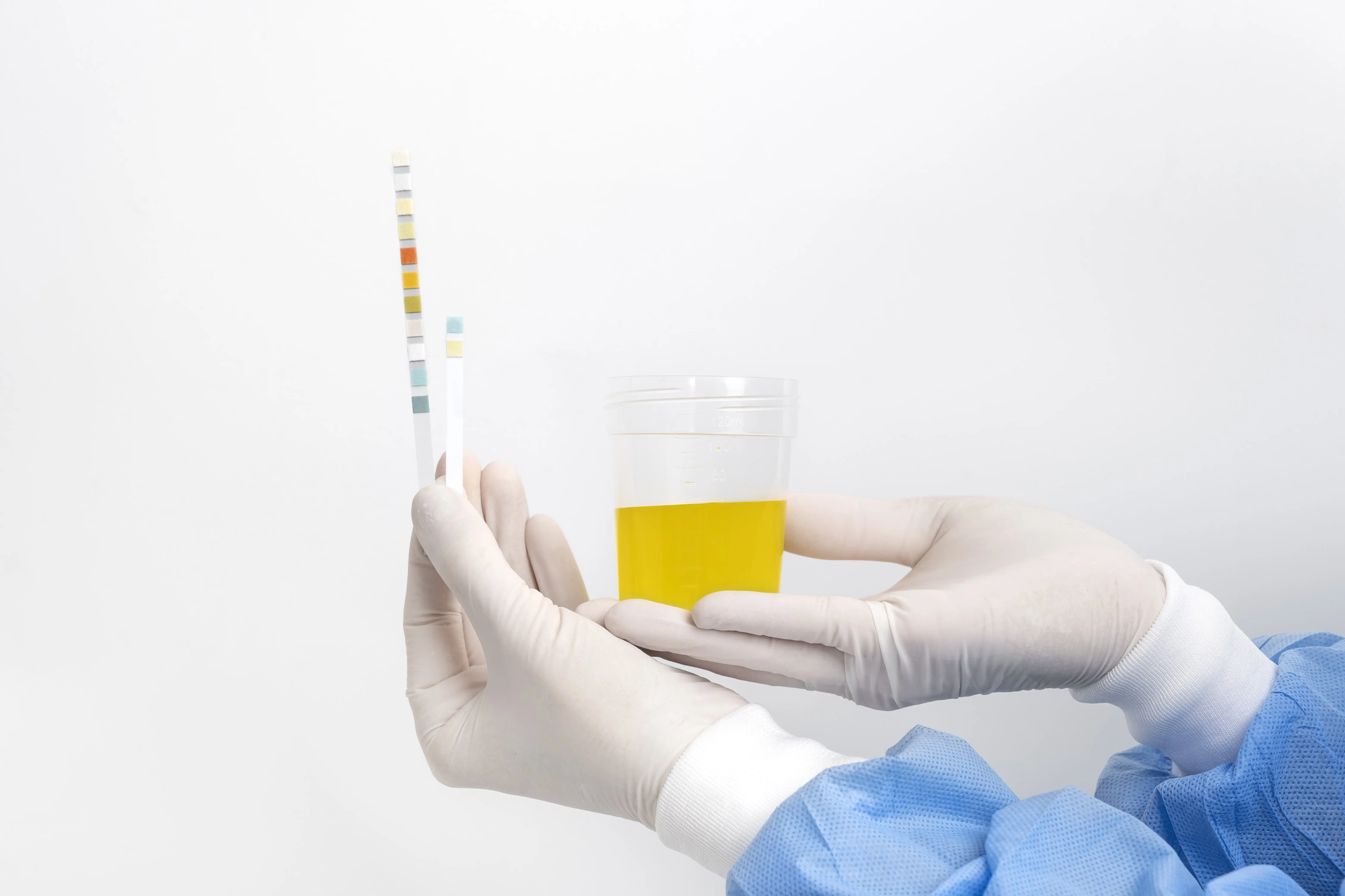 Practical Benefits of Urine Drug Test Cups